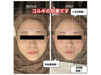 チョアチョア 札幌すすきの店(CHOA-CHOA)の写真