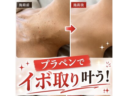 ムーン(MOON)の写真