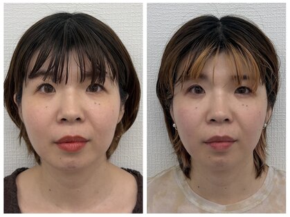 美容整骨サロン Care Lab One【小顔／姿勢改善／肩こり／骨盤矯正／新大阪】の写真
