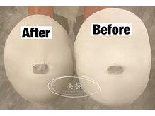 美極 トータルビューティー(美極 TOTAL BEAUTY)/恵比寿/小顔コルギ/エステ/