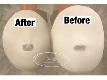 美極 トータルビューティー(美極 TOTAL BEAUTY)/恵比寿/小顔コルギ/エステ/