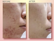 ジュリア オージェ 天王寺店/ビフォーアフター（フォトFa)