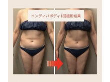 エステサロン プレスドルポ(Place De Repos)/～ボディ～