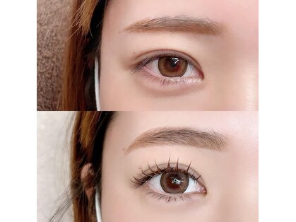 アンリミテッド(Unlimited)の写真