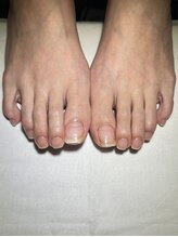 マイスタンネイル(MY STAN NAIL)/フットネイルケア