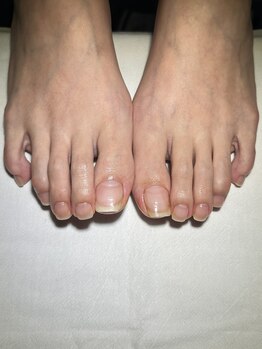 マイスタンネイル(MY STAN NAIL)/フットネイルケア