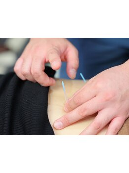 首・肩のつらさを改善したい