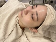 エヌインスキンケアスタジオ 天神店 N-inスキンケアスタジオ/ハーブピーリング１回目