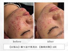 レッド(RED)/お肌の駆け込み寺はプラズマ