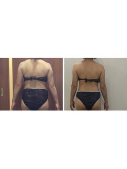 プリンセス バイ セイフティプリンセス 長野店(PRINCESS)/上半身痩せ特化メニュー