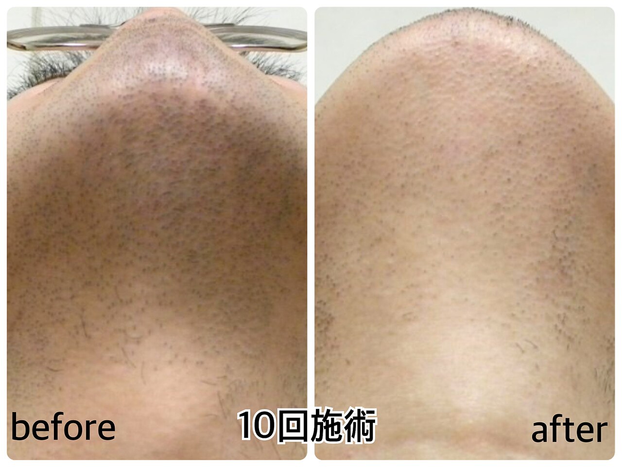 ベルエポック(ひでさん専用) champagnehouse_417679