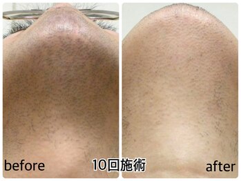 ベルエポック 八事(Belle Epoque)