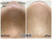 ベルエポック 八事(Belle Epoque)