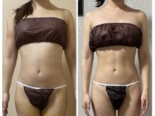 スリーピングビューティー(Sleeping Beauty)/