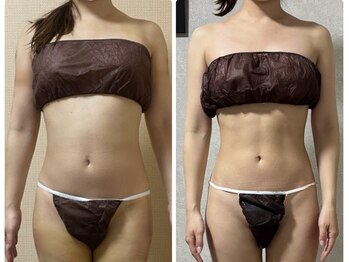 スリーピングビューティー(Sleeping Beauty)/