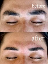 ハマザキ 東店(HAMAZAKI)/眉毛の左右差が気になる方へ