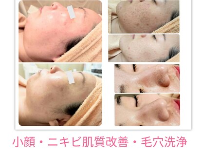 庭夢エステの写真