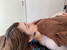 ハリファ鍼灸院 横浜関内院(HariFa鍼灸院)/美容施術