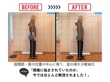 ゼロスポ アドバンス(ZEROSPO ADVANCE)/姿勢矯正