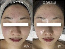 ルーナ 恵比寿(Luna)の雰囲気（大人肌を育てて強くするラミネーションピール×サーマルリフト）