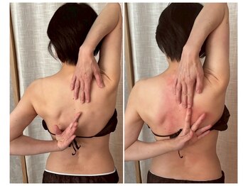 ココア(CoCoa)/肩甲骨洗浄