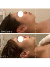 リブ シャルム(Lib Charm)/コルギマッサージ1回施術