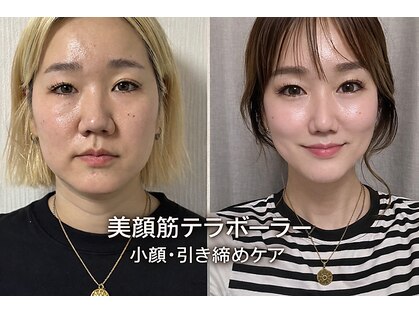 アオダモ(aodamo)の写真