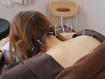 こと鍼灸院・整骨院/気になる箇所にアプローチ