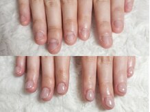 深爪矯正 爪悩み専門店 グラシナ 西宮北口店【4/3 NEW OPEN（予定）】/(深爪/長さだし/フィルイン)