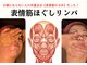 マシェリ(ma-che'rie)の写真/小顔にならない人の共通点は【顔の力み】だった！力が入りっぱなしの表情筋を緩めるだけで驚きの変化が！