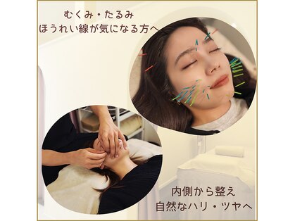 おもいやり鍼灸治療院 モーイ(mooi)の写真