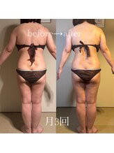 アモリール 京都北大路(Amolir)/月3回のbefore＆after