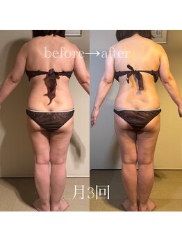 アモリール 京都北大路(Amolir)/月3回のbefore&after