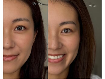 アンヴェイル(UNVEILU)の写真/似合わせ眉×毛質改善まつ毛で、毎日のメイクを楽に、もっと楽しく。
