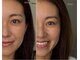 アンヴェイル(UNVEILU)の写真/似合わせ眉×毛質改善まつ毛で、毎日のメイクを楽に、もっと楽しく。