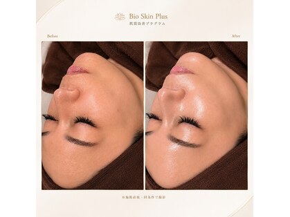 バイオ ビューティー 新潟店(Bio Beauty)の写真