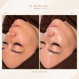 バイオ ビューティー 新潟店(Bio Beauty)