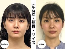 くいしばり・小顔矯正GranRoots可児院【9/26OPEN（予定）】