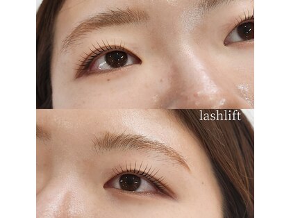 ハナナ(hanana)の写真