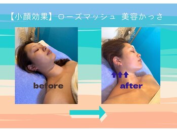 エヌスパ(NSPA)/５　ローズマッシュ&グアシャ