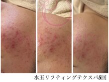 サロンヴェアリー 広尾(salon vary)/お肌のお悩みを根本から解決！！