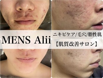 アリィ フォア メン(Alii for men)