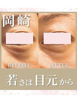 リラベル(Lira Belle)/目元のクマ撃退