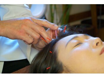 レメディ/育毛促進鍼