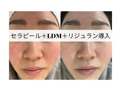 ビューティーセイバー 馬車道(BEAUTY SAVIOR)の写真