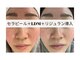 ビューティーセイバー 馬車道(BEAUTY SAVIOR)の写真