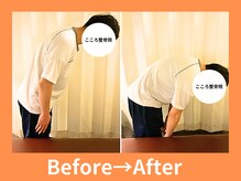 こころ整骨院/20代男性のビフォーアフター