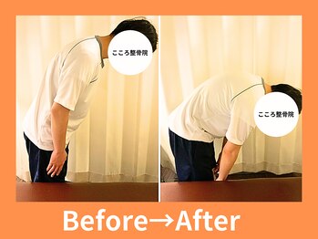 こころ整骨院/20代男性のビフォーアフター