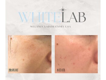 エスポワールカルド(Espoir caldo)