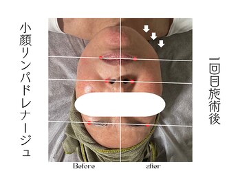 サロン デ ニコ(Salon de NIKO)/小顔リンパドレナージュ
